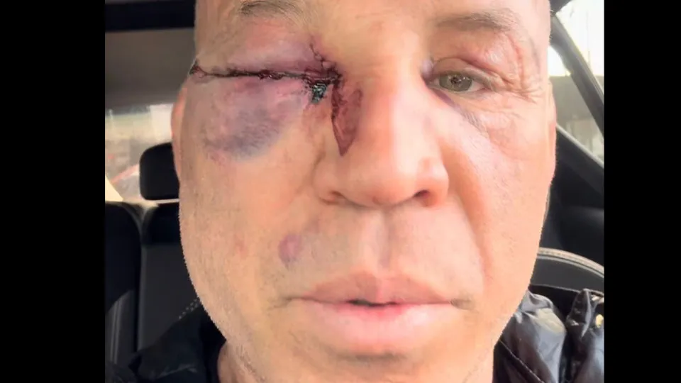 "Fui covardemente agredido", diz Wanderlei sobre briga com Popó